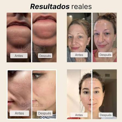 ✨KIT MELAXIN (ACLARANTE + EXFOLIANTE ARROZ)